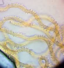 Attēlu rezultāti vaicājumam “Lycogala fuscoolearium spores”