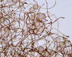 Attēlu rezultāti vaicājumam “Comatricha elegans var. microspora”