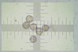 Attēlu rezultāti vaicājumam “Didymium nigripes young”