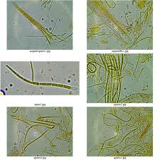 Attēlu rezultāti vaicājumam “Stictis”