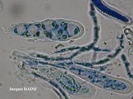 Attēlu rezultāti vaicājumam “Caloplaca scopularis”