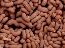 Attēlu rezultāti vaicājumam “Arcyria stipata spores”