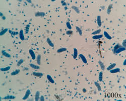 Attēlu rezultāti vaicājumam “Dacrymyces chrysospermus spores”