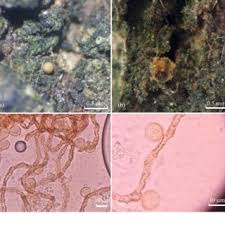 Attēlu rezultāti vaicājumam “Symphytocarpus impexus spores”