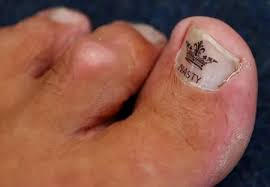 Image result for Toe Wrestling World Championships