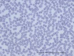 Attēlu rezultāti vaicājumam “undetermined plasmodium”