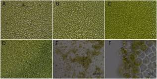 Attēlu rezultāti vaicājumam “Oligonema flavidum spores”