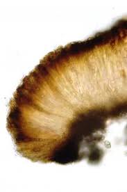 Attēlu rezultāti vaicājumam “Trapelia coarctata”