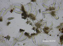 Attēlu rezultāti vaicājumam “Phlyctis agelaea”