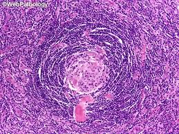 Attēlu rezultāti vaicājumam “Jungermannia hyalina cells”