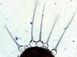 Attēlu rezultāti vaicājumam “Badhamia affinis var. microspora”
