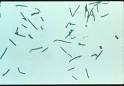 Clostridium - MicrobeWiki