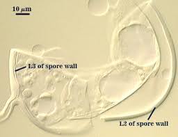 Attēlu rezultāti vaicājumam “Gulielmina vermicularis spores”