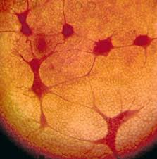 Attēlu rezultāti vaicājumam “Cribraria intricata”