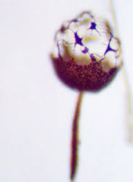 Attēlu rezultāti vaicājumam “Claustria didermoides stalked”