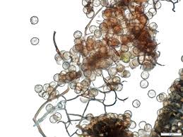 Attēlu rezultāti vaicājumam “Stemonitis axifera var. smithii spores”