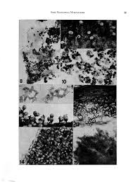Attēlu rezultāti vaicājumam “Hemitrichia leiotricha spores”