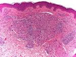 <b>plasma cells</b> and
