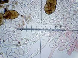 Attēlu rezultāti vaicājumam “Melanospora lagenaria”