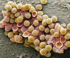 Attēlu rezultāti vaicājumam “Hemitrichia serpula spores”