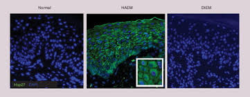 Attēlu rezultāti vaicājumam “Diderma simplex”