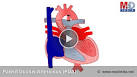 <b>Ductus Arteriosus</b> (PDA)