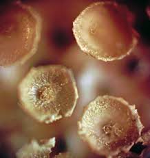 Attēlu rezultāti vaicājumam “Hemitrichia sordivesiculosa sessile”