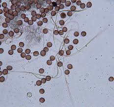 Attēlu rezultāti vaicājumam “Diderma globosum”