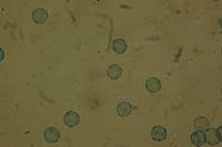 Attēlu rezultāti vaicājumam “Arcyria incarnata”