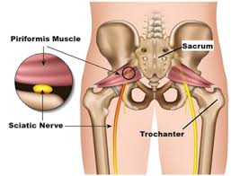 Attēlu rezultāti vaicājumam “Cribraria piriformis”