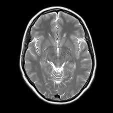 Image result for no brain