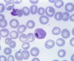 Attēlu rezultāti vaicājumam “Physarum virescens plasmodium”