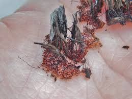 Attēlu rezultāti vaicājumam “Stemonitis fusca var. nigrescens spores”