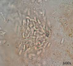 Attēlu rezultāti vaicājumam “Dacrymyces chrysospermus spores”