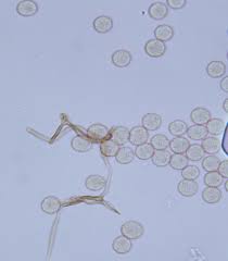 Attēlu rezultāti vaicājumam “Stemonitopsis hyperopta var. landewaldii young”