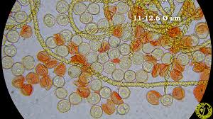 Attēlu rezultāti vaicājumam “Hemitrichia leiotricha macro”
