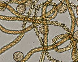 Attēlu rezultāti vaicājumam “Trichia decipiens”