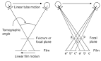 <b>Tomography</b>, Fig. 2