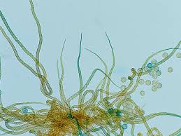 Attēlu rezultāti vaicājumam “Trichia crateriformis”