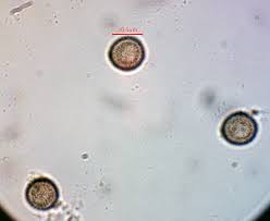 Attēlu rezultāti vaicājumam “Comatricha ellae stalked”