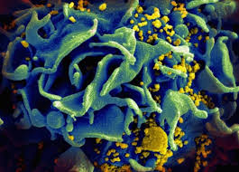 Image result for фотография вируса вич