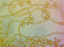 Attēlu rezultāti vaicājumam “Lycogala ustulatum sessile”