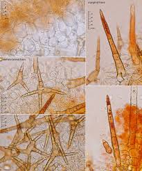 Attēlu rezultāti vaicājumam “Cheilymenia stercorea”
