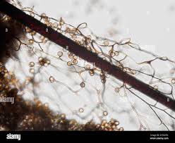 Attēlu rezultāti vaicājumam “Stemonitis fusca spores”