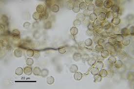 Attēlu rezultāti vaicājumam “Reticularia jurana spores”