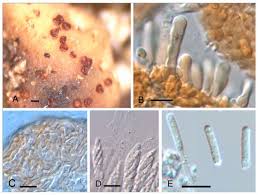 Attēlu rezultāti vaicājumam “Licea castanea spores”