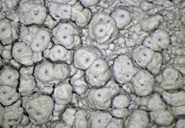 Attēlu rezultāti vaicājumam “Pertusaria flavida”