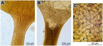 Attēlu rezultāti vaicājumam “Oligonema flavidum spores”
