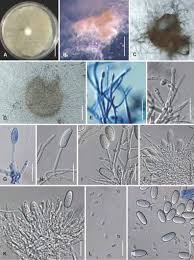 Attēlu rezultāti vaicājumam “Nectria episphaeria”