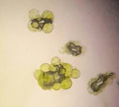 Attēlu rezultāti vaicājumam “Lycogala alisaulianovae young”